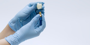 Gloved hands holding model of a dental implant